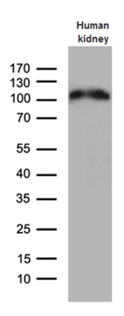 ACE2 Mouse anti-Human, Clone: OTI2G7, lyophilized, TrueMAB 100 &mu;g; Unconjugated:Antibodies,