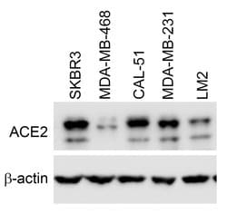 Invitrogen ACE2 Recombinant Rabbit Monoclonal Antibody (SN0754) 100 &mu;L | Buy Online | Invitrogen&trade; | Fisher Scientific