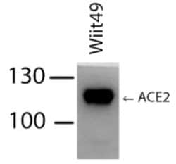 Invitrogen ACE2 Recombinant Rabbit Monoclonal Antibody (SN0754) 100 &mu;L | Buy Online | Invitrogen&trade; | Fisher Scientific
