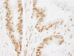 ACINUS/ACN1 Rabbit anti-Human, Polyclonal, Bethyl Laboratories 100 &mu;L;