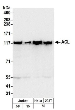 ACL Rabbit anti-Human, Mouse, Polyclonal, Bethyl Laboratories 100 &mu;L;