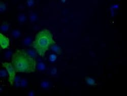 ACLY Mouse anti-Human, Clone: OTI3G8, lyophilized, TrueMAB 100 μg; Unconjugated:Antibodies,