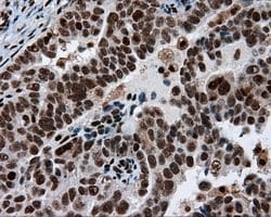 ACLY Mouse anti-Human, Clone: OTI3G8, lyophilized, TrueMAB 100 μg; Unconjugated:Antibodies,