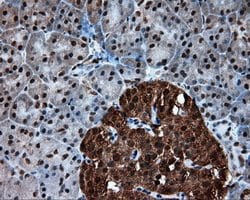 ACLY Mouse anti-Human, Clone: OTI3G8, lyophilized, TrueMAB 100 μg; Unconjugated:Antibodies,