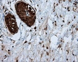ACLY Mouse anti-Human, Clone: OTI3G8, lyophilized, TrueMAB 100 μg; Unconjugated:Antibodies,