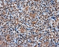 ACLY Mouse anti-Human, Clone: OTI3G8, lyophilized, TrueMAB 100 μg; Unconjugated:Antibodies,