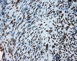 ACLY Mouse anti-Human, Clone: OTI3G8, lyophilized, TrueMAB 100 μg; Unconjugated:Antibodies,