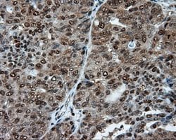 ACLY Mouse anti-Human, Clone: OTI3G8, lyophilized, TrueMAB 100 μg; Unconjugated:Antibodies,