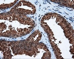 ACLY Mouse anti-Human, Clone: OTI3G8, lyophilized, TrueMAB 100 μg; Unconjugated:Antibodies,