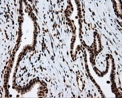 ACLY Mouse anti-Human, Clone: OTI3G8, lyophilized, TrueMAB 100 μg; Unconjugated:Antibodies,