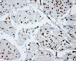 ACLY Mouse anti-Human, Clone: OTI3G8, lyophilized, TrueMAB 100 μg; Unconjugated:Antibodies,
