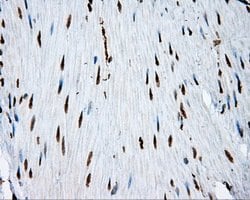 ACLY Mouse anti-Human, Clone: OTI3G8, lyophilized, TrueMAB 100 μg; Unconjugated:Antibodies,