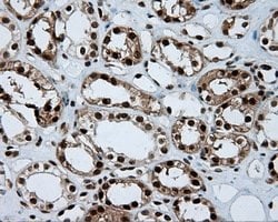 ACLY Mouse anti-Human, Clone: OTI3G8, lyophilized, TrueMAB 100 μg; Unconjugated:Antibodies,