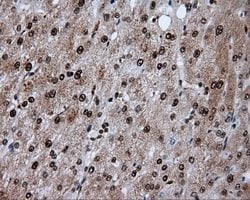 ACLY Mouse anti-Human, Clone: OTI3G8, lyophilized, TrueMAB 100 μg; Unconjugated:Antibodies,