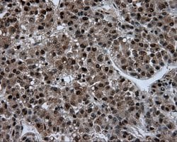 ACLY Mouse anti-Human, Clone: OTI3G8, lyophilized, TrueMAB 100 μg; Unconjugated:Antibodies,