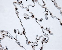 ACLY Mouse anti-Human, Clone: OTI3G8, lyophilized, TrueMAB 100 μg; Unconjugated:Antibodies,