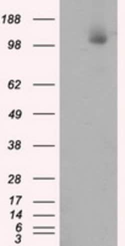 ACLY Mouse anti-Human, Clone: OTI3G8, lyophilized, TrueMAB 100 μg; Unconjugated:Antibodies,