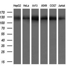 ACLY Mouse anti-Human, Clone: OTI3G8, lyophilized, TrueMAB 100 μg; Unconjugated:Antibodies,