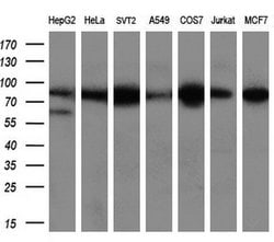 ACO2 Mouse anti-Human, Clone: OTI7G4, liquid, TrueMAB 100 &mu;L; Unconjugated:Antibodies,