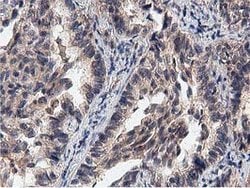 ACOT12 Mouse anti-Human, Clone: OTI1A11, lyophilized, TrueMAB 100 &mu;g;