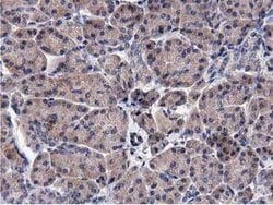 ACOT12 Mouse anti-Human, Clone: OTI1A11, lyophilized, TrueMAB 100 &mu;g;