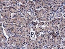 ACOT12 Monoclonal Antibody (OTI1A11), TrueMAB , OriGene 100 &mu;L; Unconjugated:Antibodies,