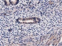 ACOT12 Mouse anti-Human, Clone: OTI1A11, lyophilized, TrueMAB 100 &mu;g;