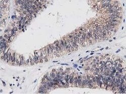 ACOT12 Mouse anti-Human, Clone: OTI1A11, lyophilized, TrueMAB 100 &mu;g;