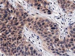 ACOT12 Mouse anti-Human, Clone: OTI1A11, lyophilized, TrueMAB 100 &mu;g;