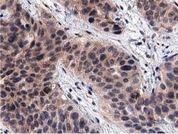 ACOT12 Monoclonal Antibody (OTI1A11), TrueMAB , OriGene:Antibodies:Primary