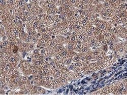 ACOT12 Mouse anti-Human, Clone: OTI1A11, lyophilized, TrueMAB 100 &mu;g;