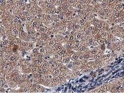 ACOT12 Monoclonal Antibody (OTI1A11), TrueMAB , OriGene 100 &mu;L; Unconjugated:Antibodies,