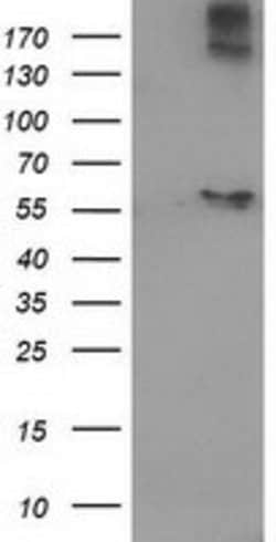ACOT12 Mouse anti-Human, Clone: OTI1A11, lyophilized, TrueMAB 100 &mu;g;