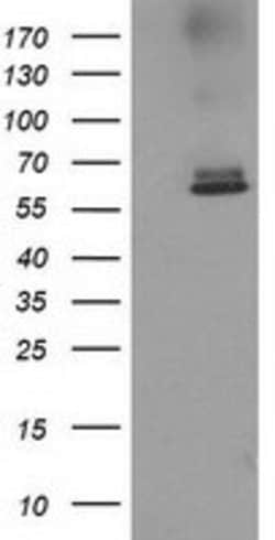 ACOT12 Mouse anti-Human, Clone: OTI2D11, lyophilized, TrueMAB 100 &mu;g;