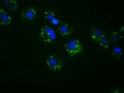 ACSBG1 Mouse anti-Human, Clone: OTI2B5, lyophilized, TrueMAB 100 &mu;g;