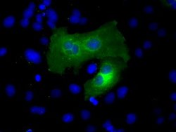 ACSBG1 Mouse anti-Human, Clone: OTI1D8, lyophilized, TrueMAB 100 &mu;g;