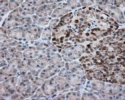 ACSBG1 Mouse anti-Human, Clone: OTI2B5, lyophilized, TrueMAB 100 &mu;g;