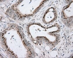 ACSBG1 Mouse anti-Human, Clone: OTI2B5, lyophilized, TrueMAB 100 &mu;g;