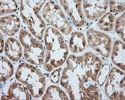 ACSBG1 Mouse anti-Human, Clone: OTI2B5, lyophilized, TrueMAB 100 &mu;g;