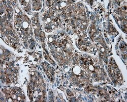 ACSBG1 Mouse anti-Human, Clone: OTI2B5, lyophilized, TrueMAB 100 &mu;g;