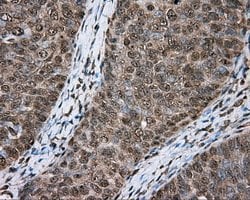 ACSBG1 Mouse anti-Human, Clone: OTI2B6, lyophilized, TrueMAB 100 &mu;g;