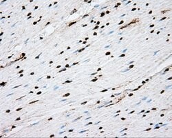 ACSBG1 Mouse anti-Human, Clone: OTI2B6, lyophilized, TrueMAB 100 &mu;g;