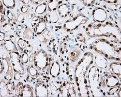 ACSBG1 Mouse anti-Human, Clone: OTI2B6, lyophilized, TrueMAB 100 &mu;g;