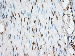 ACSBG1 Mouse anti-Human, Clone: OTI1D8, lyophilized, TrueMAB 100 &mu;g;