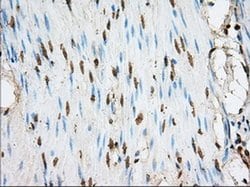 ACSBG1 Monoclonal Antibody (OTI1D8), TrueMAB , OriGene 100 &mu;L; Unconjugated:Antibodies,