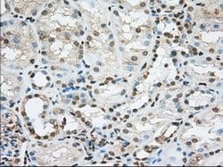 ACSBG1 Monoclonal Antibody (OTI1D8), TrueMAB , OriGene 100 &mu;L; Unconjugated:Antibodies,