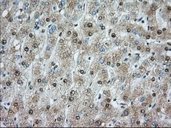 ACSBG1 Mouse anti-Human, Clone: OTI1D8, lyophilized, TrueMAB 100 &mu;g;