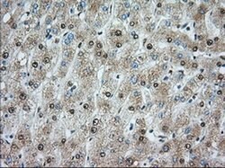ACSBG1 Monoclonal Antibody (OTI1D8), TrueMAB , OriGene 100 &mu;L; Unconjugated:Antibodies,