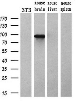 ACSBG1 Mouse anti-Human, Clone: OTI2B6, lyophilized, TrueMAB 100 &mu;g;