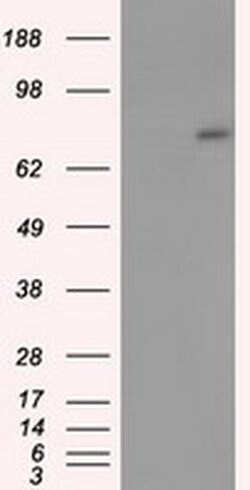 ACSBG1 Monoclonal Antibody (OTI1D8), TrueMAB , OriGene 100 &mu;L; Unconjugated:Antibodies,